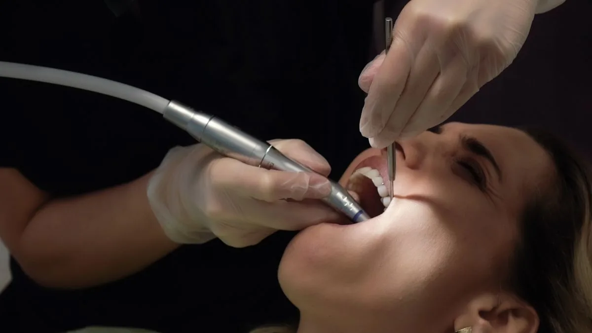 Dental professional using an ultrasonic scaler to remove tartar near the gumline
