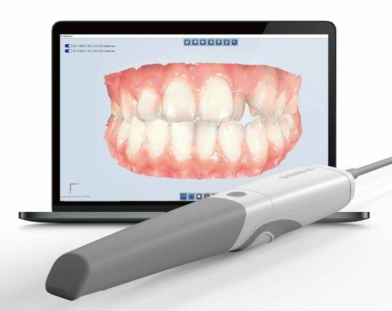 Dental Scanner