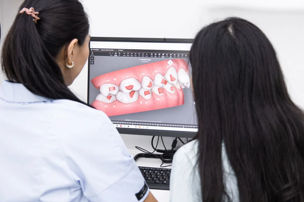 Dental team reviewing a 3D digital impression of teeth on a computer screen