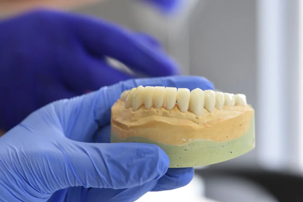 A model of a dental crown held in a gloved hand