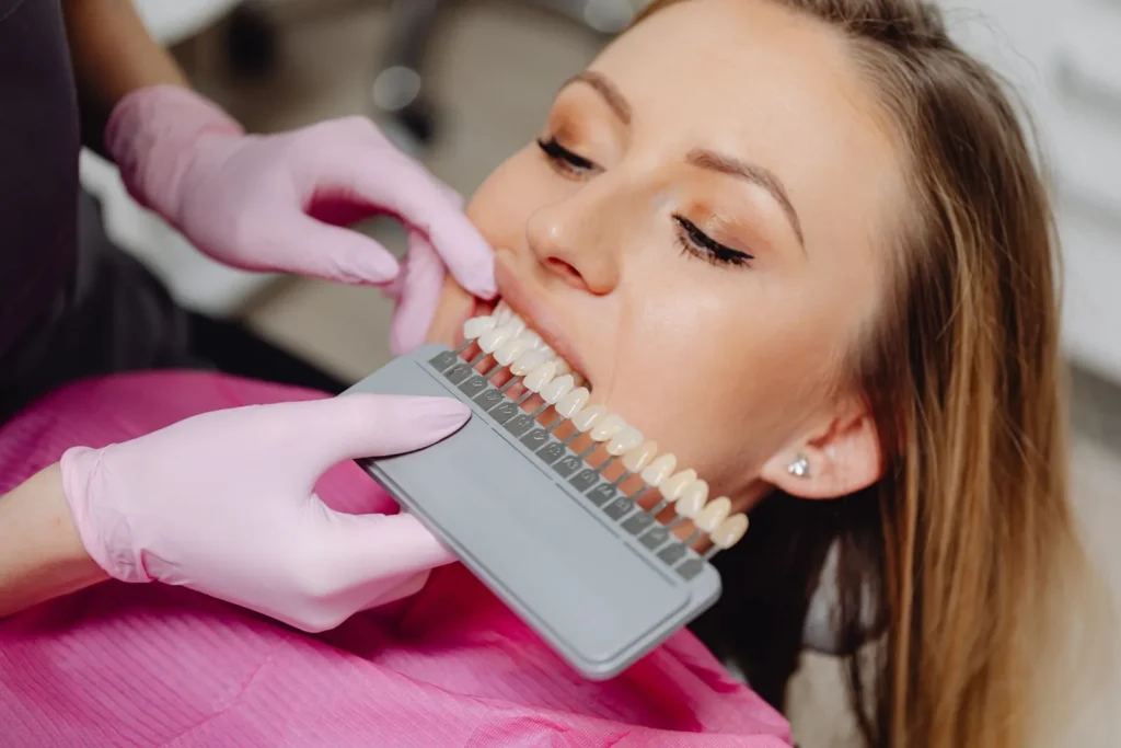 A dentist matching tooth shade for a veneer