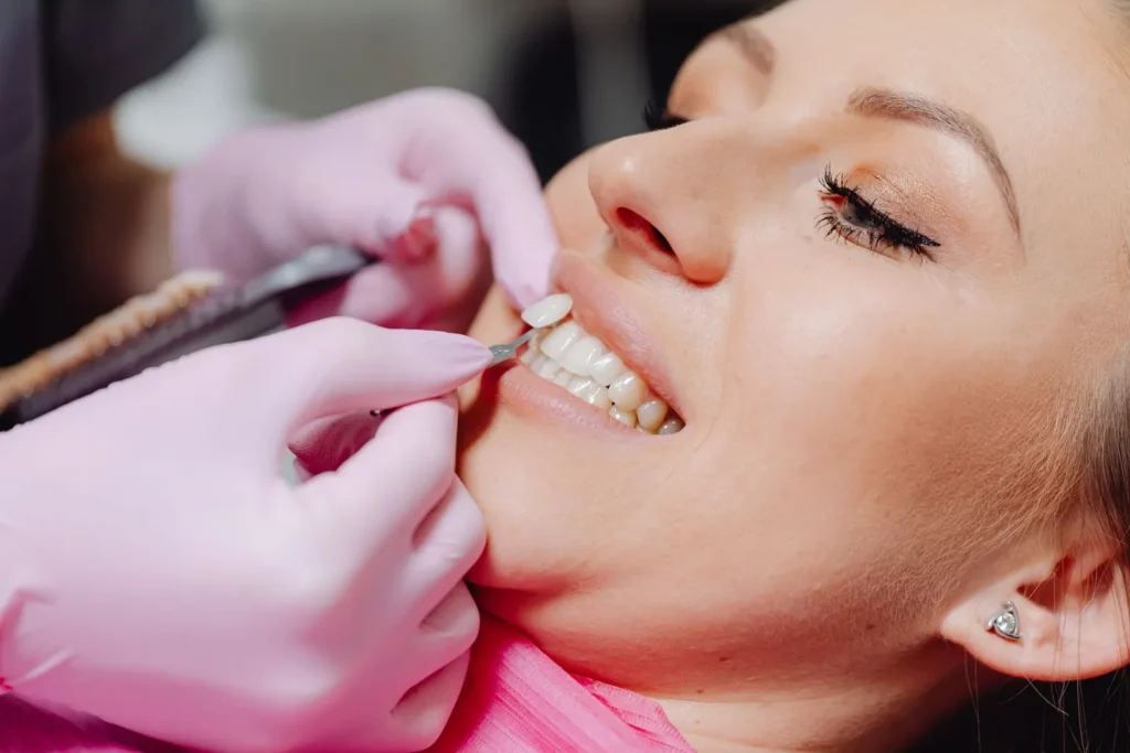 A dentist matching tooth color with a shade guide